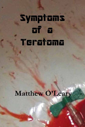 Symptoms of a Teratoma